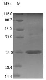 Rat SERPINA1 / Alpha 1 Antitrypsin Protein (Recombinant 6His-SUMO, N-terminus)