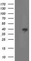 RLBP1 / CRALBP Antibody (clone OTI1B4)
