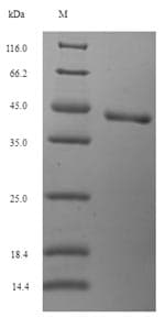Rat OSTN / Musclin / Osteocrin Protein (Recombinant 6His-SUMO, N-terminus)
