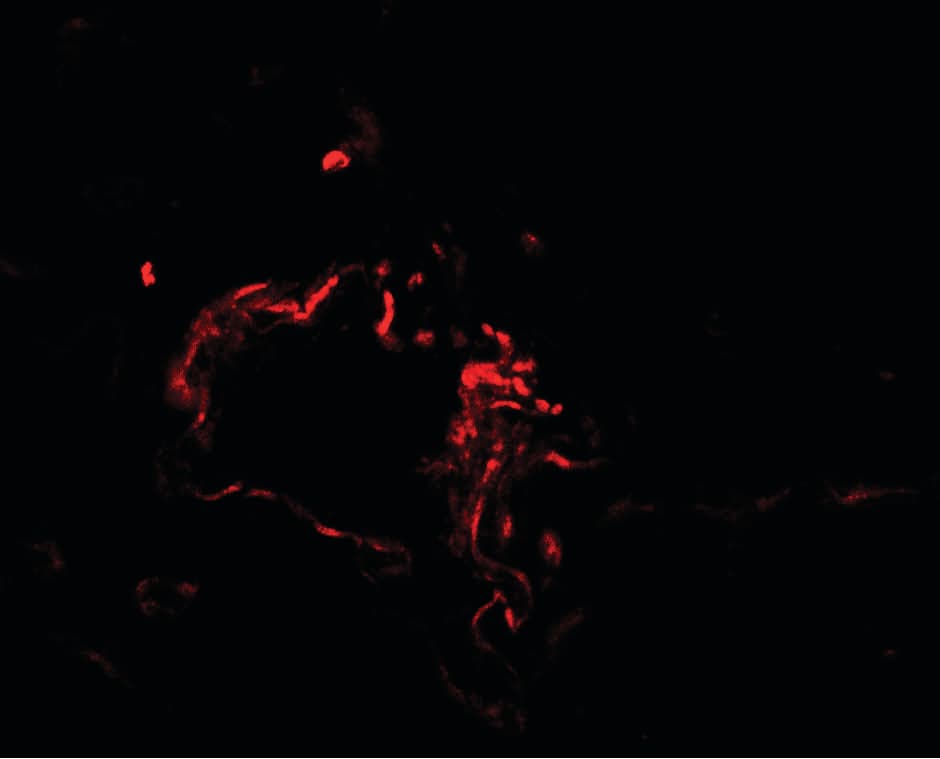 IHC-plus™ Polyclonal Rabbit anti-Human FACL2 / ACSL1 Antibody (IHC, IF, WB)
