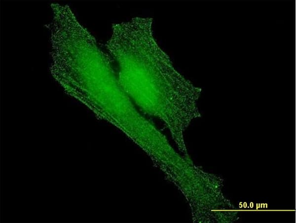 BARD1 Antibody (clone 2A11)