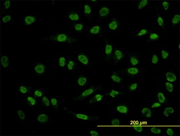 Monoclonal Mouse anti-Human POU4F3 / BRN3C Antibody (clone 5B8, IF, WB)