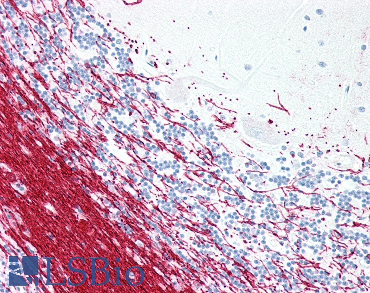 PathPlus™ MBP / Myelin Basic Protein Antibody (clone ABT-MBP)