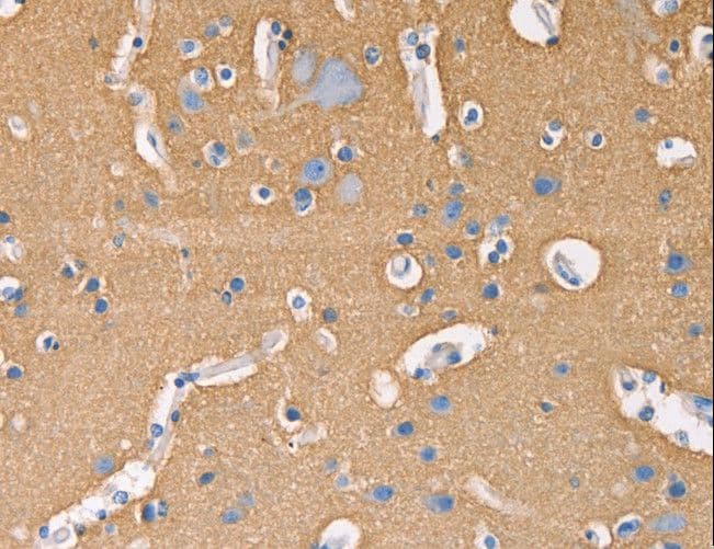 GNB1 Antibody