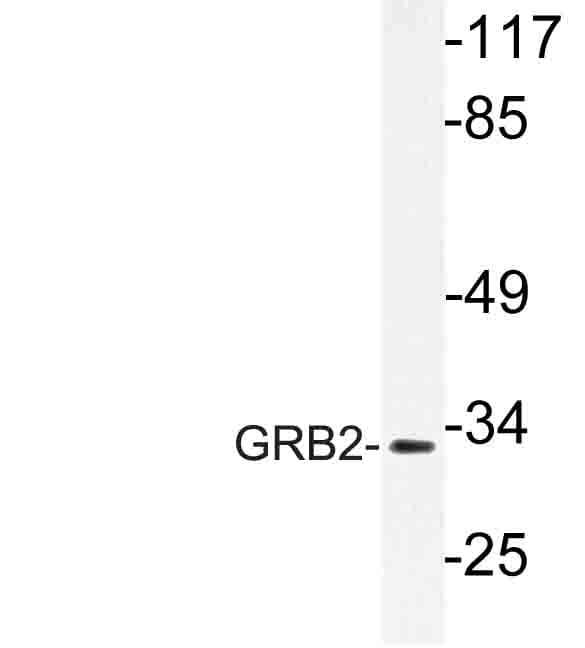 GRB2 Antibody (Arg178)