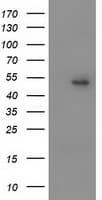 PPARA / PPAR Alpha Antibody (clone OTI1E11)