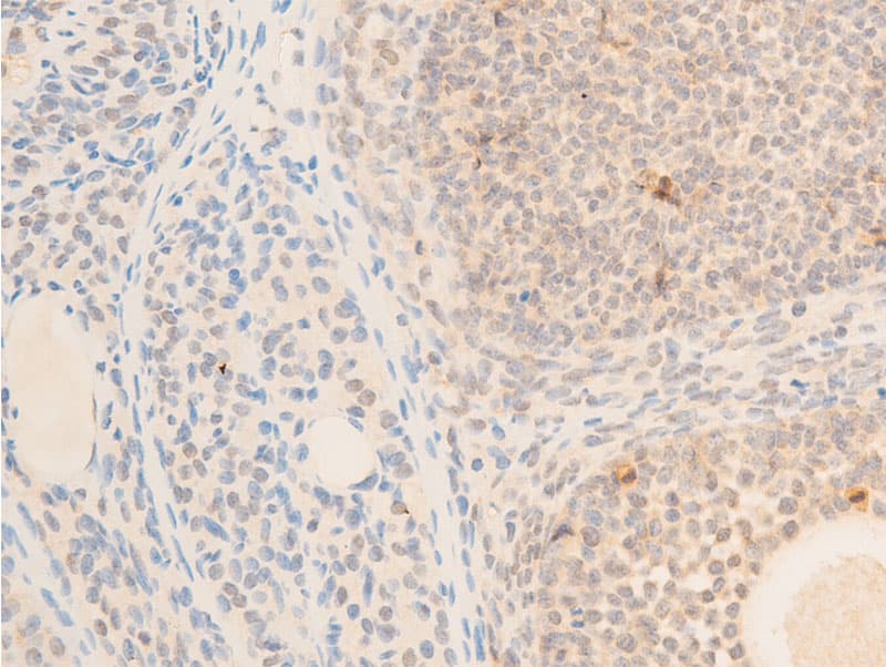 MAP3K7 / TAK1 Antibody (phospho-Thr187)