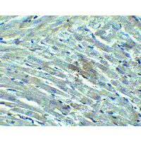 DDX58 / RIG-1 / RIG-I Antibody