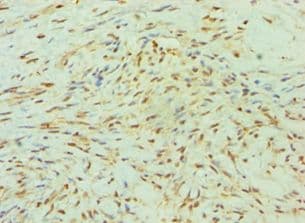 SMYD3 Antibody (aa199-428)