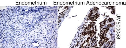 Monoclonal Mouse anti-Human TP53 / p53 Antibody (clone UMAB62, IHC, IF, WB)