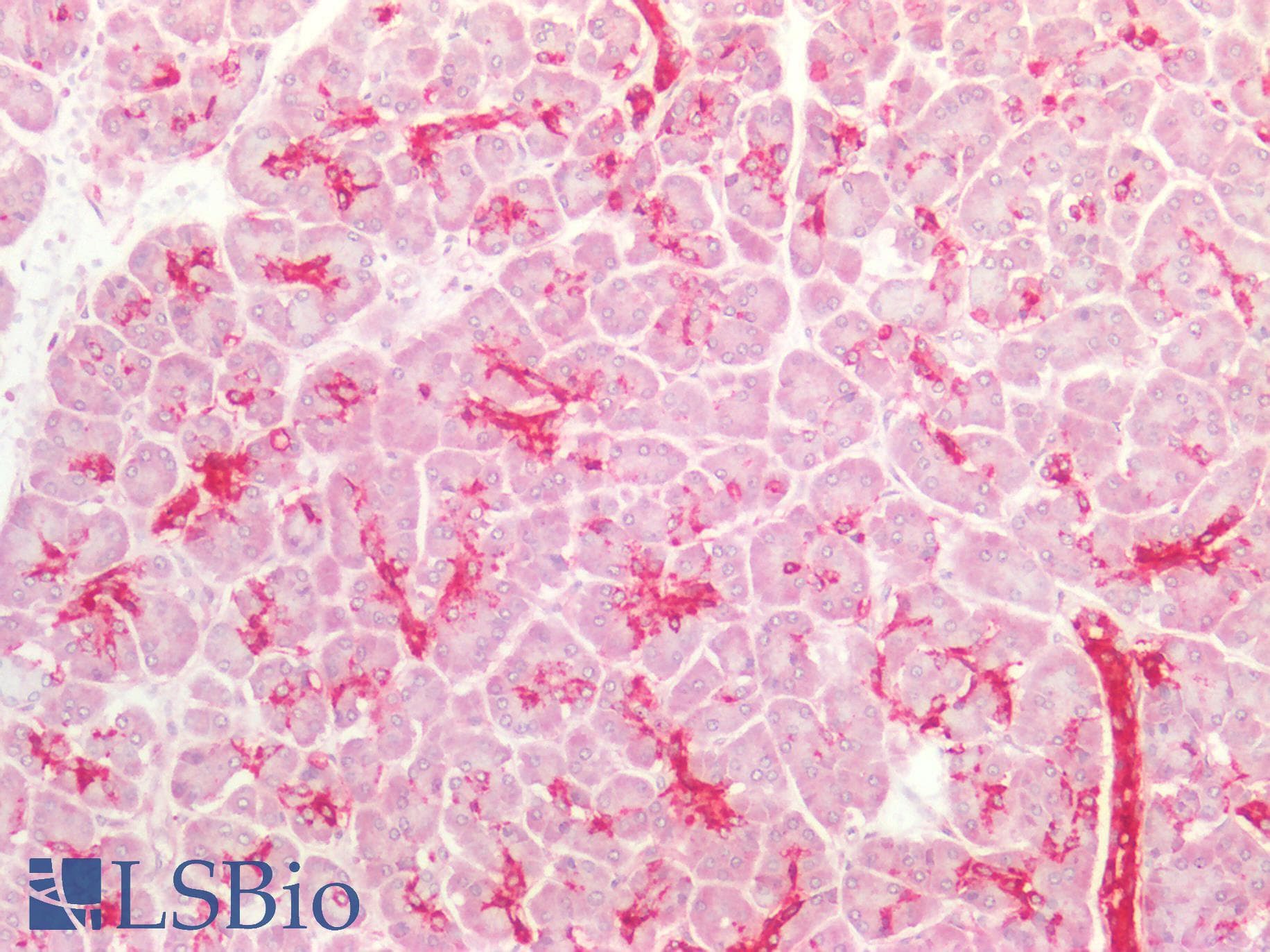 PathPlus™ ST6GAL1 / CD75 Antibody (aa178-206)