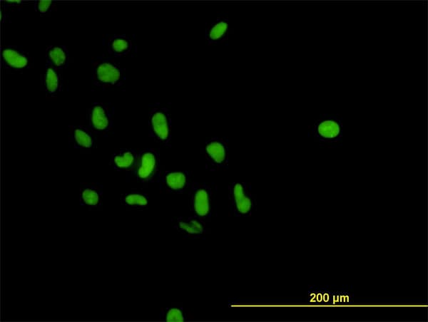 Monoclonal Mouse anti-Human PARP1 Antibody (clone 3G4, IF, WB)