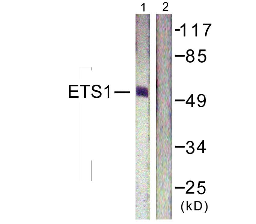 Polyclonal Rabbit anti-Human ETS1 / ETS-1 Antibody (p38, IHC, IF, WB)