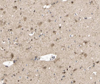 STAT5A Antibody (phospho-Ser780)