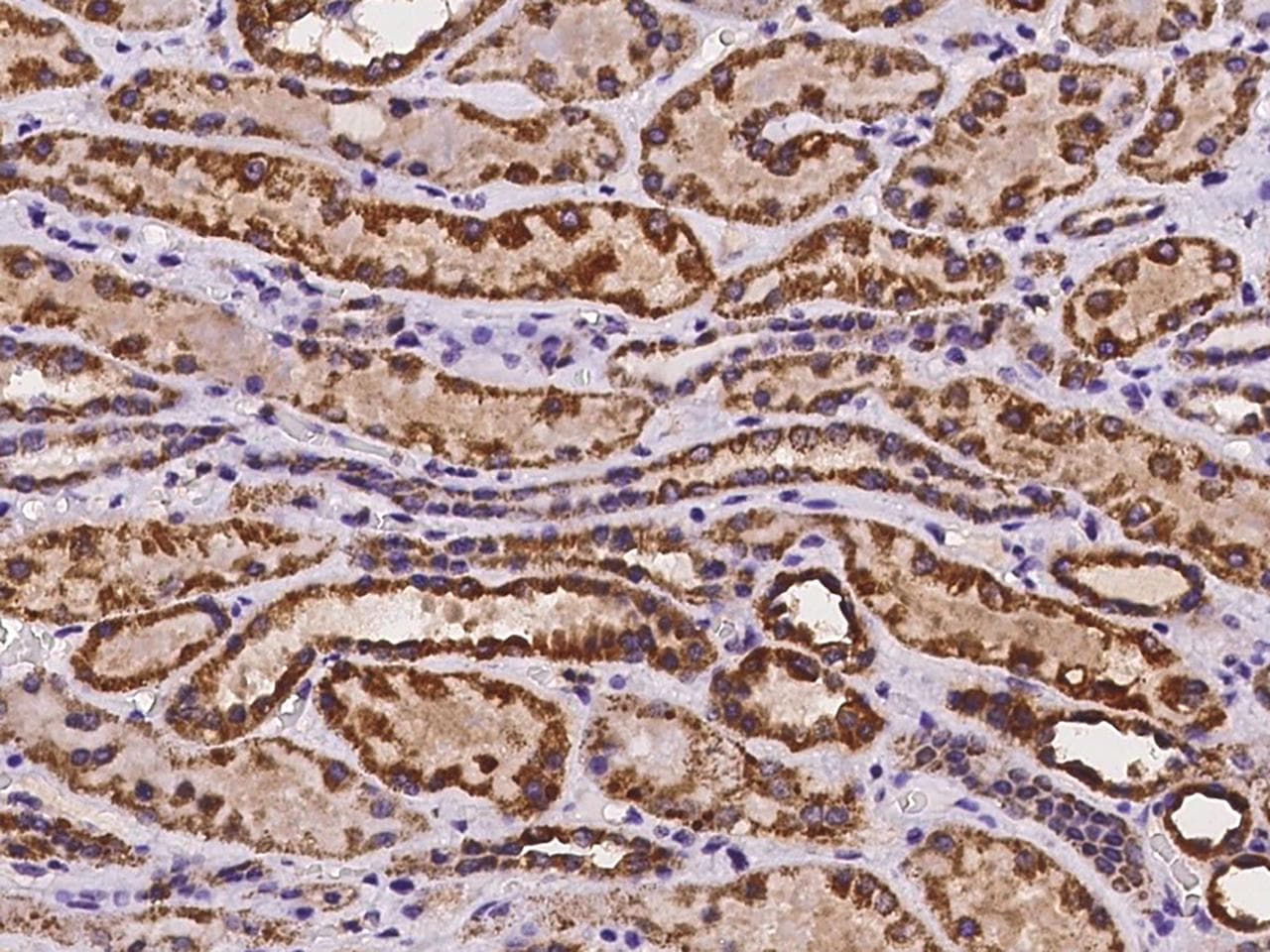 MYLK4 Antibody