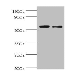 Polyclonal Rabbit anti-Human PGD Antibody (IHC, WB)