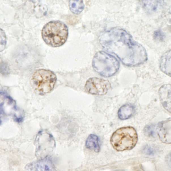 DDX46 Antibody (aa981-C-term)