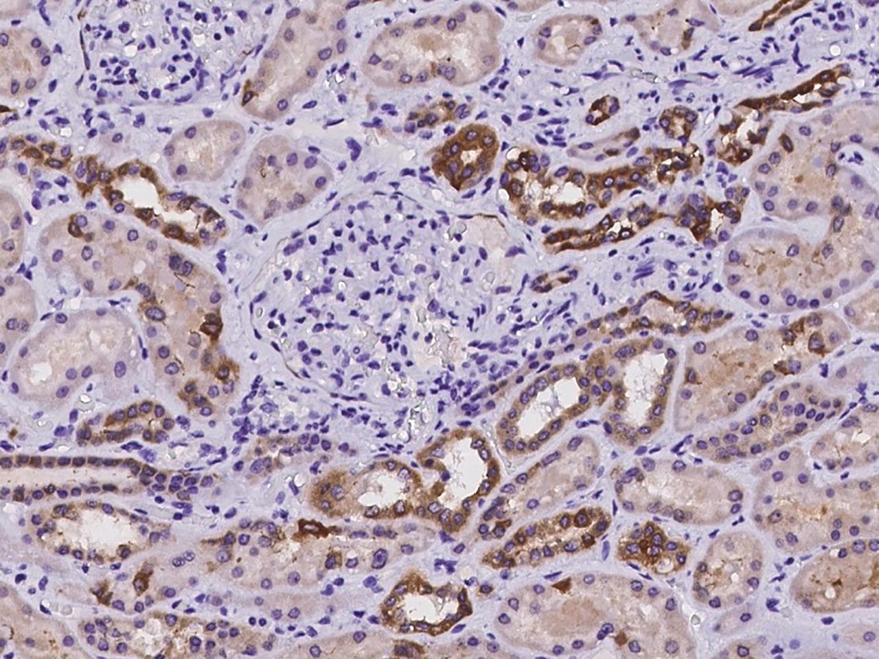 DCDC2 Antibody