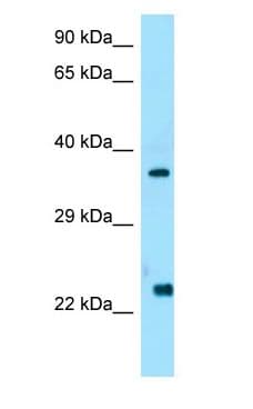 CCN5 Antibody (C-Terminus)