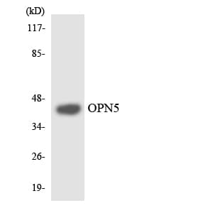 IHC-plus™ Polyclonal Rabbit anti-Human OPN5 / Neuropsin Antibody (aa237-286, IHC, WB)