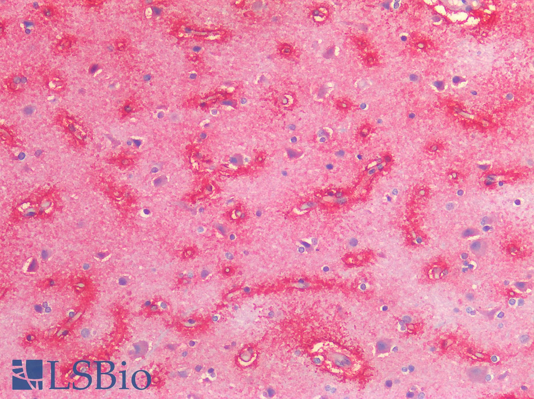IHC-plus™ MYC / c-Myc Antibody