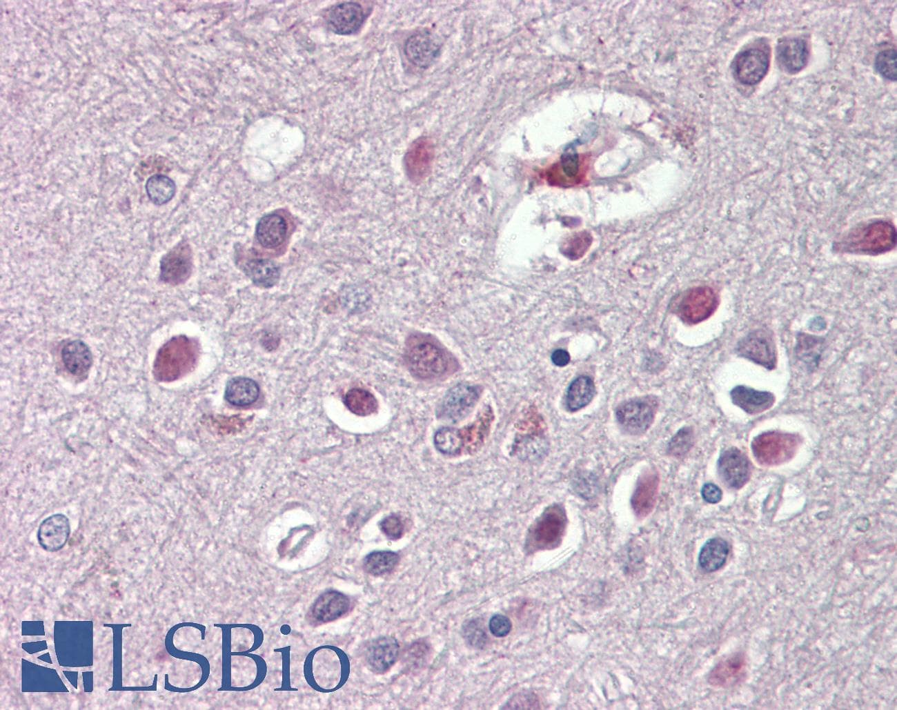 IHC-plus™ ARHGDIG / RHOGDI-3 Antibody (aa43-54)