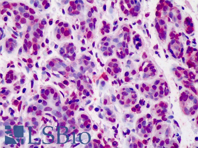 IHC-plus™ BCL2 / Bcl-2 Antibody (clone Bcl-2/100, FITC)