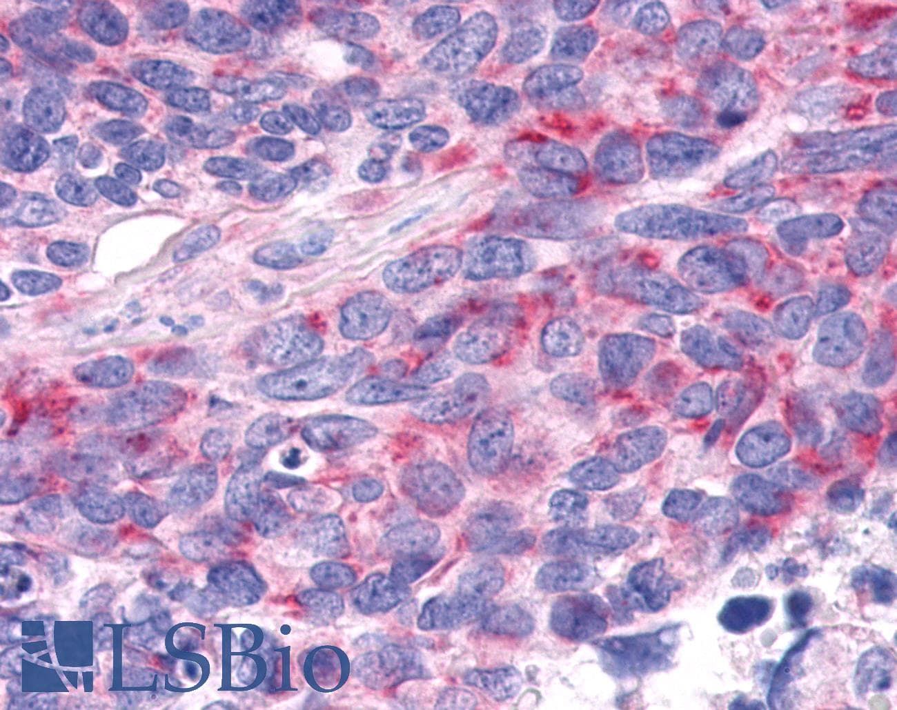 PathPlus™ Polyclonal Rabbit anti-Human RORA / ROR Alpha Antibody (Ligand-binding Domain, IHC)
