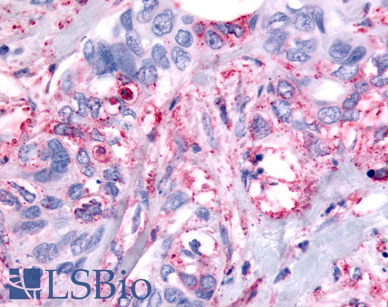 PathPlus™ Polyclonal Rabbit anti-Human PAK6 Antibody (Linker Domain, IHC)