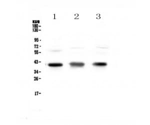 Polyclonal Rabbit anti-Human CCR4 Antibody (WB)