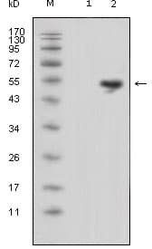IHC-plus™ LCN1 / Lipocalin-1 Antibody (clone 10B10)