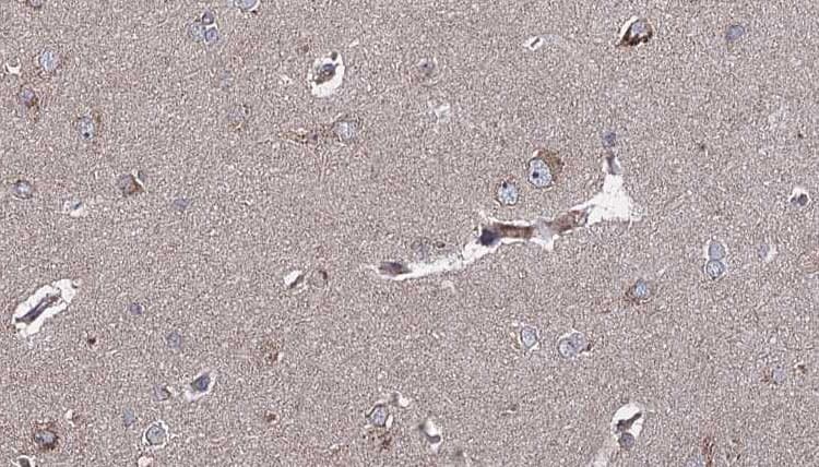Polyclonal Rabbit anti-Human NTRK2 / TRKB Antibody (IHC, IF, WB)