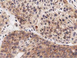 Monoclonal Mouse anti-Human GPR49 / LGR5 Antibody (clone OTI2H7, aa250-550, IHC, IF, WB)