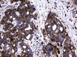 GLB1 / Beta-Galactosidase Antibody (clone OTI1C9)