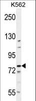 Polyclonal Rabbit anti-Human BCL11B Antibody (aa307-334, WB)