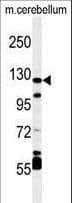 Polyclonal Rabbit anti-Human HIF1A / HIF1 Alpha Antibody (aa728-757, IHC, IF, WB)