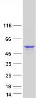 Human SEPT14 Protein (Recombinant Myc-DDK (Flag))