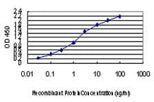 AATK / AATYK Antibody (clone 5H5)