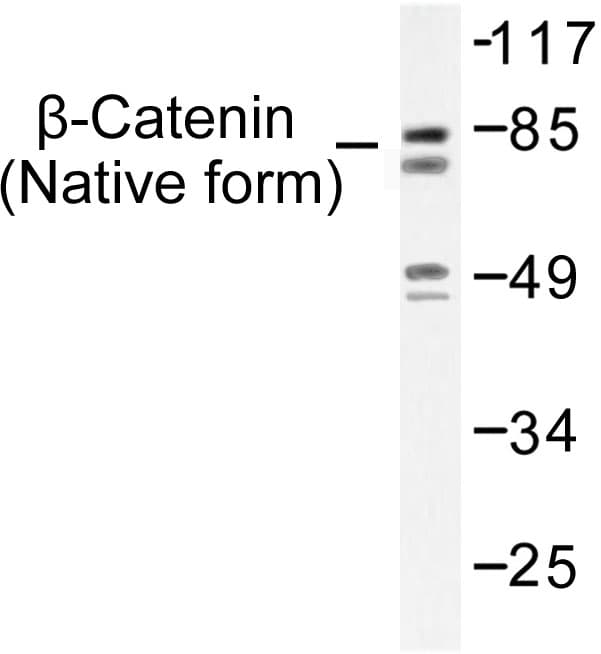 CTNNB1 / Beta Catenin Antibody (Ile35)