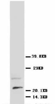 NGF Antibody (N-Terminus)