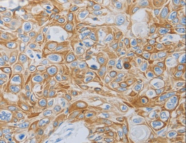 MC5R / MC5 Receptor Antibody