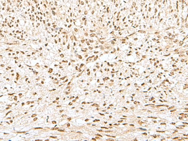 Polyclonal Rabbit anti-Human GTF2A2 / TFIIA Antibody (IHC)