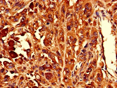 RPL10L Antibody