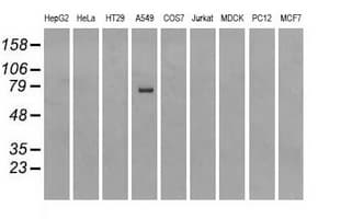 Heat Shock Protein 70 / HSPA1A Antibody (clone OTI1H5)