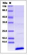 Human CD81 Protein (Recombinant)