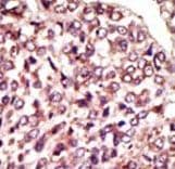 MGAT / GLYT1 Antibody (C-Terminus)