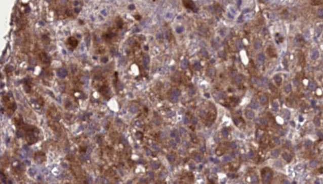 SLC22A6 / OAT1 Antibody