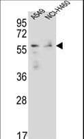 FOXN1 Antibody (aa350-378)