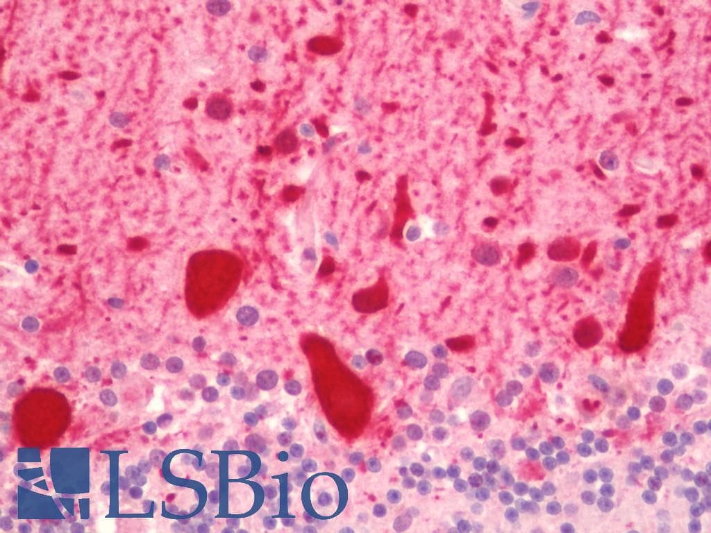IHC-plus™ PVALB / Parvalbumin Antibody (aa51-100)
