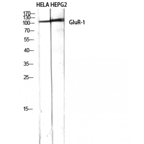 IHC-plus™ GRIA1 / GLUR1 Antibody (790-870 aa)